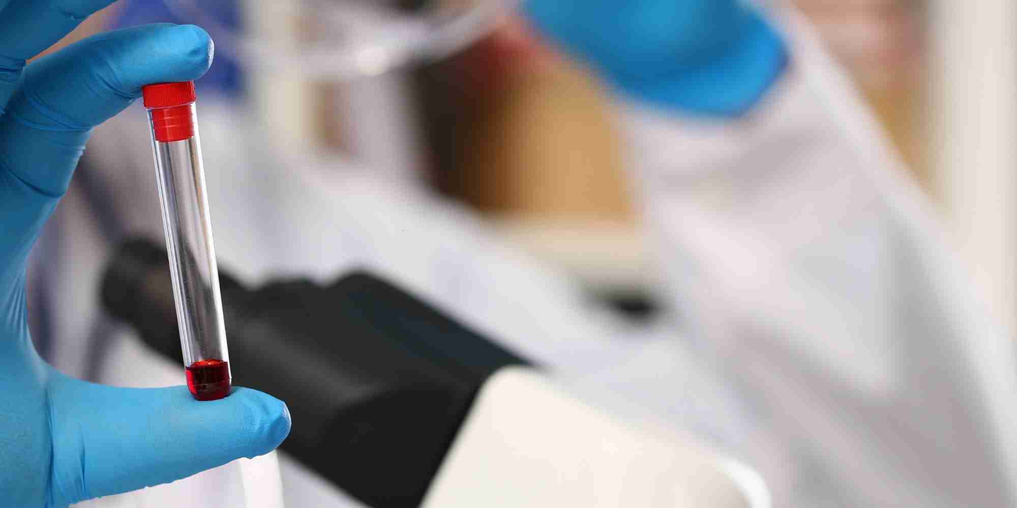 Dia Mundial da Doa&ccedil;&atilde;o de Medula &Oacute;ssea