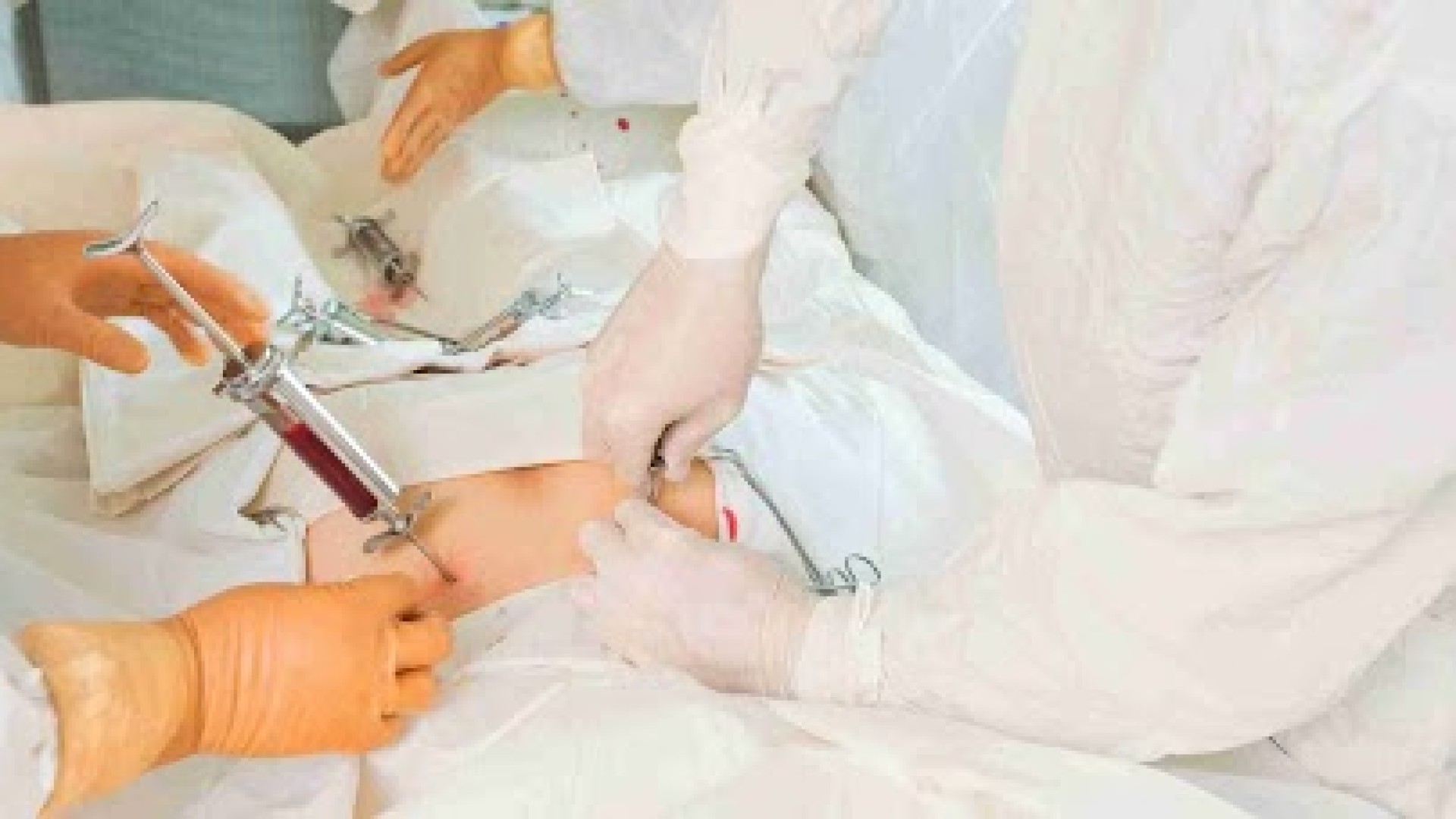 Dia Mundial Da Doação De Medula Óssea